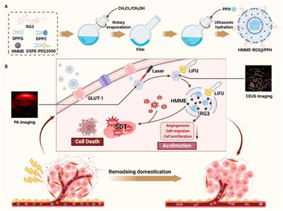 An alternative way to break the matrix barrier: an experimental study of a LIFU-mediated, visualizable targeted nanoparticle synergistic amplification for the treatment of malignant fibroblasts